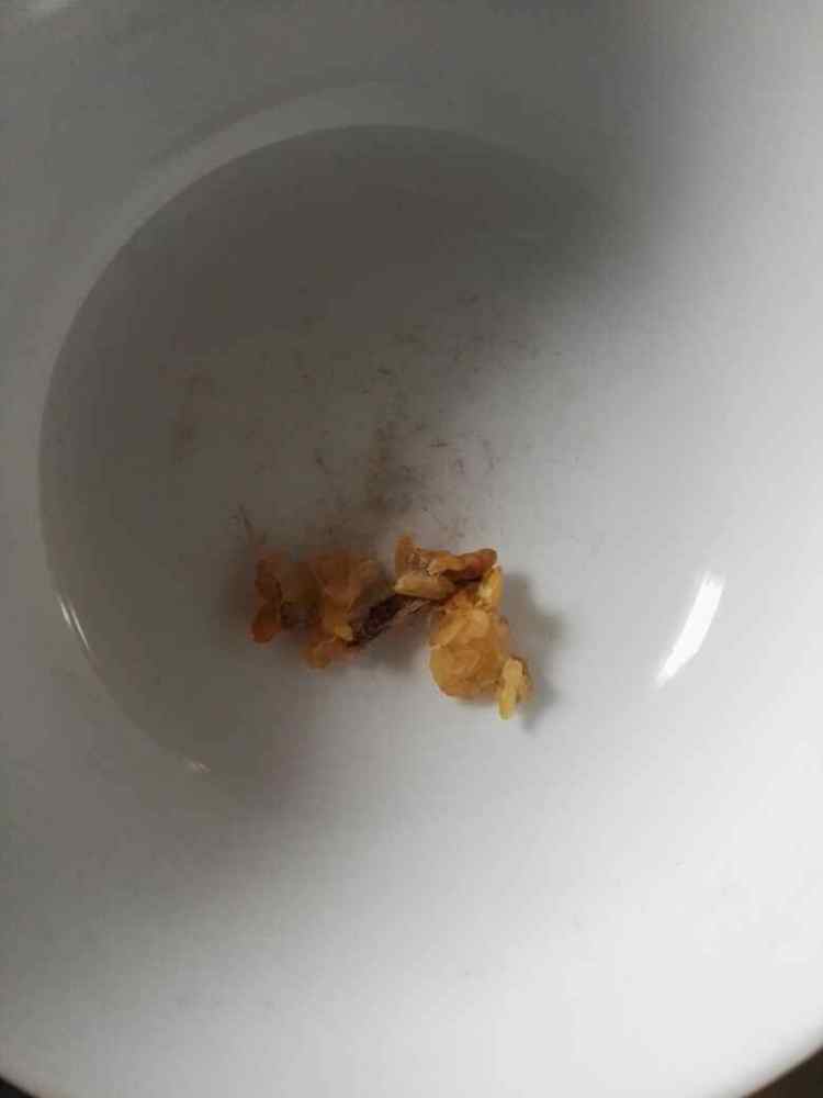 雪蛤木瓜汤步骤1