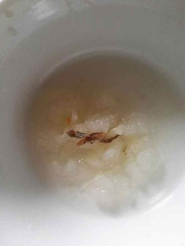 雪蛤木瓜汤步骤2