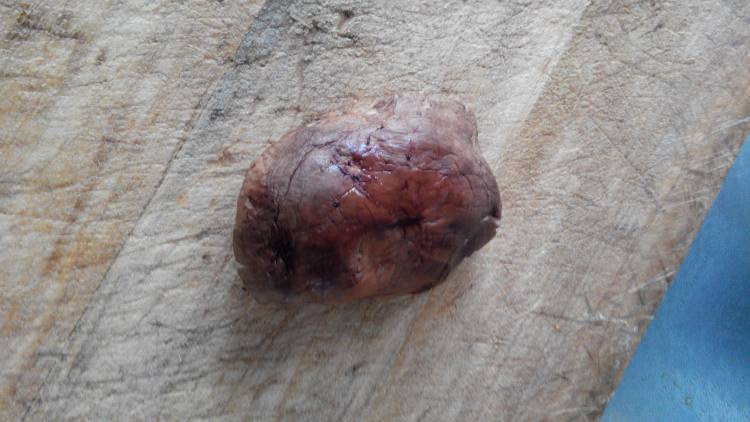 香菇鸡蛋煎饼步骤4