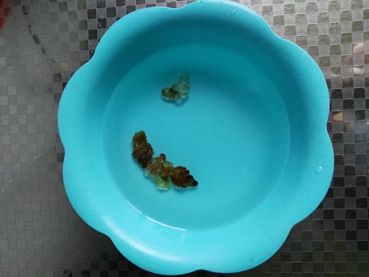 桃胶皂角米银耳汤步骤3